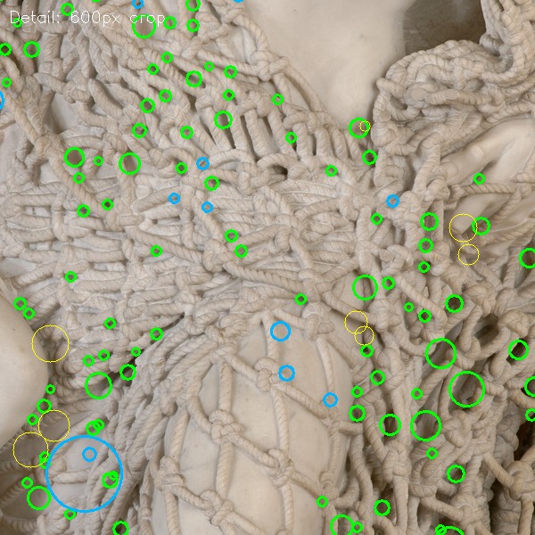 detection zoom